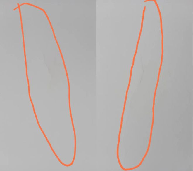 装修一半墙体开裂温州新房业主急坏了！(图1)